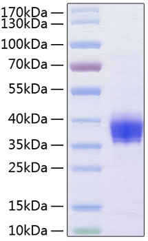 Recombinant Human Ep-CAM/TROP-1/CD326 Protein
