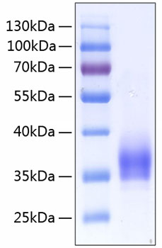 Recombinant Human IL-2-RA/CD25  Protein