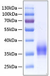 Recombinant Human IL-2-RA/CD25  Protein (RP00076)