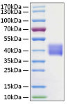 Recombinant Human Kallikrein-1/KLK1 Protein (RP00078)