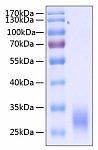 Recombinant Human Fc-gamma RIIa/CD32a(H167R) Protein (RP00081)