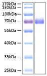 Recombinant Human EphA2/ECK Protein (RP00082)