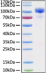 Recombinant Human ErbB-3/HER3 Protein (RP00083)