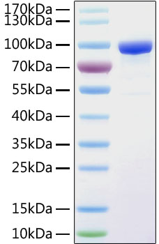 Recombinant Human sTfR/CD71 Protein