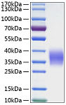 Recombinant Human Ephrin-B2/EFNB2 Protein (RP00091)