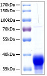 Recombinant Human Ephrin-B1/EFNB1 Protein (RP00092)