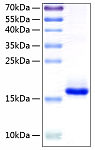 Recombinant Human IL-10 Protein (RP00093)
