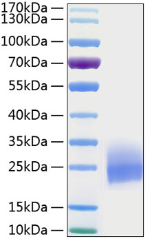 Recombinant Human CSF-2/GM-CSF Protein