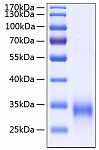 Recombinant Human MBP-C/MBL-2 Protein (RP00095)