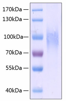 Recombinant Human PECAM-1/CD31 Protein