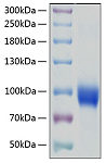 Recombinant Human IL-18R1/CD218a Protein (RP00097)