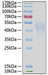Recombinant Human IL-4RA/CD124 Protein (RP00099)