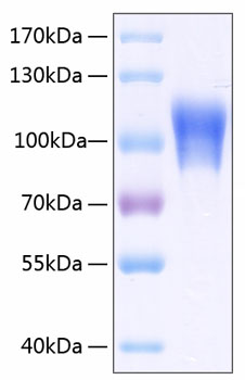 Recombinant Human MCAM/CD146 Protein