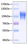 Recombinant Human MCAM/CD146 Protein (RP00101)