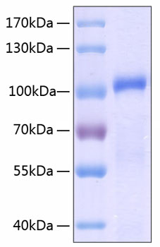 Recombinant Human MMP-9 Protein