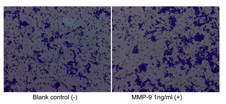 Recombinant Human MMP-9 Protein