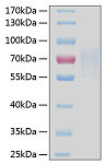 Recombinant Human TNFRSF8/CD30 Protein (RP00106)