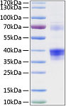 Recombinant Human Clusterin/Apo-J/CLU Protein (RP00109)