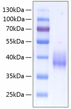 Recombinant Human Coagulation factor III/CD142 Protein