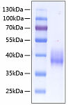 Recombinant Human Coagulation factor III/CD142 Protein (RP00112)