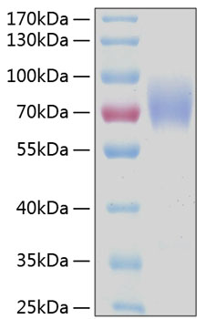Recombinant Human IgA Fc receptor/CD89 Protein