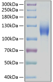 Recombinant Human c-Kit/CD117 Protein