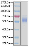 Recombinant Human DDR2/CD167b Protein (RP00115)