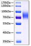 Recombinant Human MIC-B Protein (RP00118)