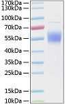 Recombinant Human IL-3RA/CD123 Protein (RP00121)