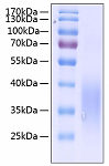 Recombinant Human c-Kit ligand/SCF/KITLG Protein (RP00124)