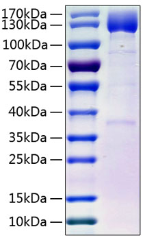 Recombinant Human PDGFR-beta/CD140b(E241D) Protein