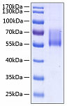 Recombinant Human MUC-1/CD227 Protein (RP00129)