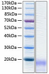 Recombinant Human CEACAM3/CD66d Protein (RP00131)