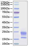 Recombinant Human WAP5/WFDC2/HE4 Protein (RP00132)