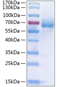 Recombinant Human LIMP II/SCARB2/CD36L2 Protein