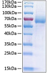 Recombinant Human LIMP II/SCARB2/CD36L2 Protein (RP00135)