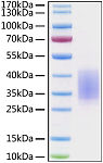 Recombinant Human CD28 Protein (RP00136)