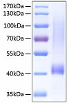 Recombinant Human Biglycan/BGN Protein (RP00141)