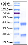 Recombinant Human Complement C1r subcomponent Protein (RP00142)