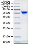 Recombinant Human Ephrin-A4/EFNA4 Protein (RP00143)