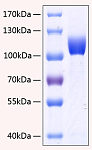 Recombinant Human FGFR-3/CD333 Protein (RP00144)