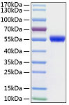 Recombinant Human uPA/PLAU Protein (RP00146LQ)