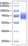 Recombinant Human Serpin F2/Alpha-2-antiplasmin Protein (RP00147)