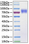 Recombinant Human Vanin-1/VNN1 Protein (RP00148)