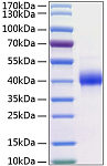 Recombinant Human Kallikrein-11/KLK11 Protein (RP00149)