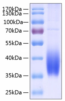 Recombinant Human B7-DC/PD-L2/CD273 Protein
