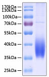 Recombinant Human B7-DC/PD-L2/CD273 Protein (RP00150)