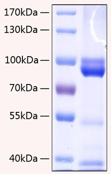 Recombinant Human AGER/RAGE Protein