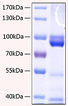 Recombinant Human AGER/RAGE Protein (RP00154)