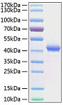 Recombinant Human TNFRSF17/BCMA/CD269 Protein (RP00155)